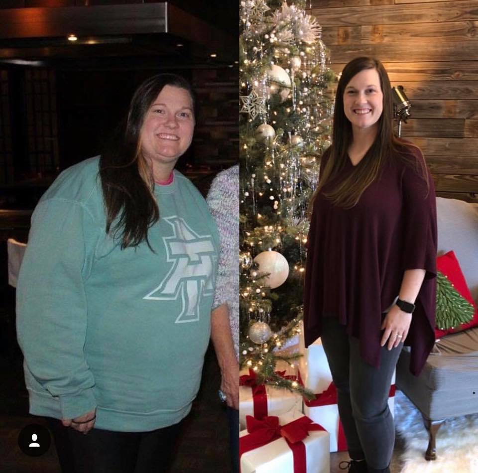 Medical Weight Loss in Tulsa Before & After Photos