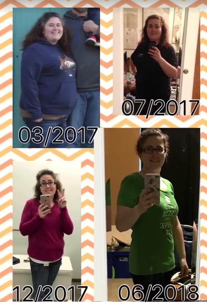 Medical Weight Loss in Tulsa Before & After Photos