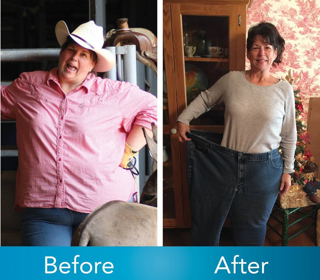 Medical Weight Loss in Tulsa Before & After Photos