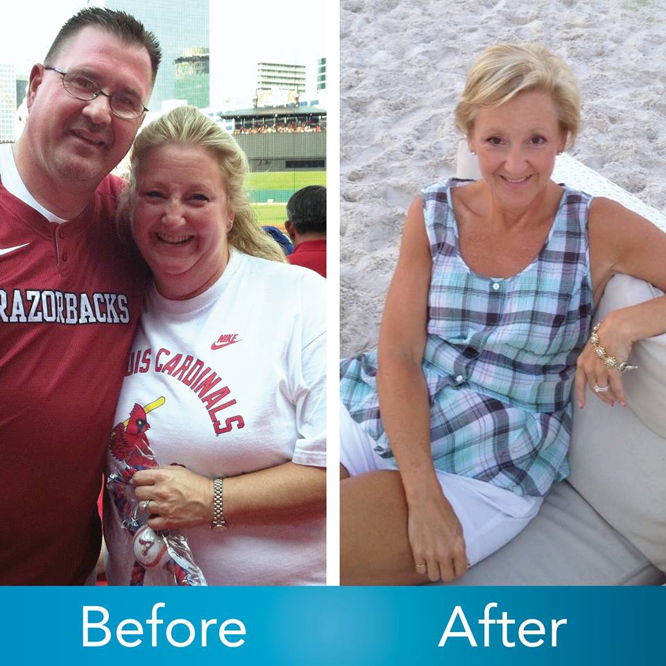 Medical Weight Loss in Tulsa Before & After Photos