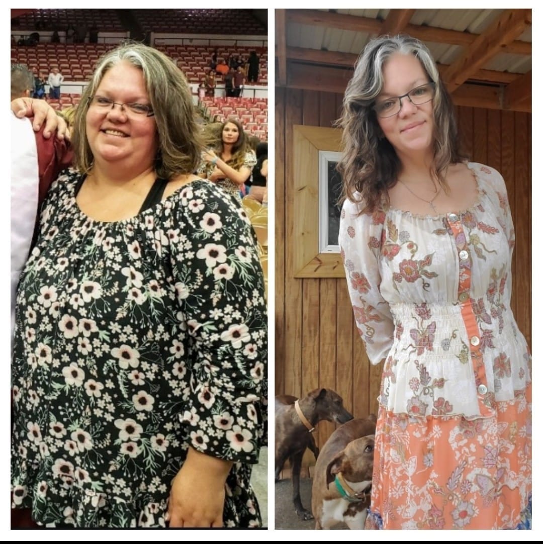 Medical Weight Loss in Tulsa Before & After Photos