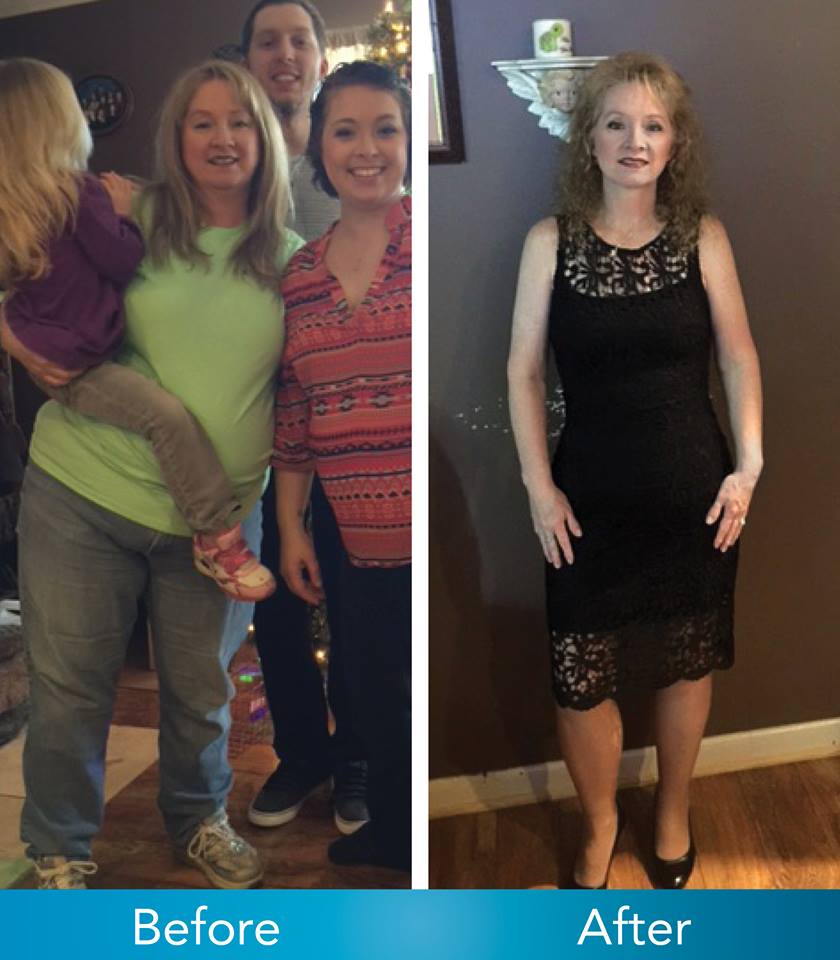 Medical Weight Loss in Tulsa Before & After Photos