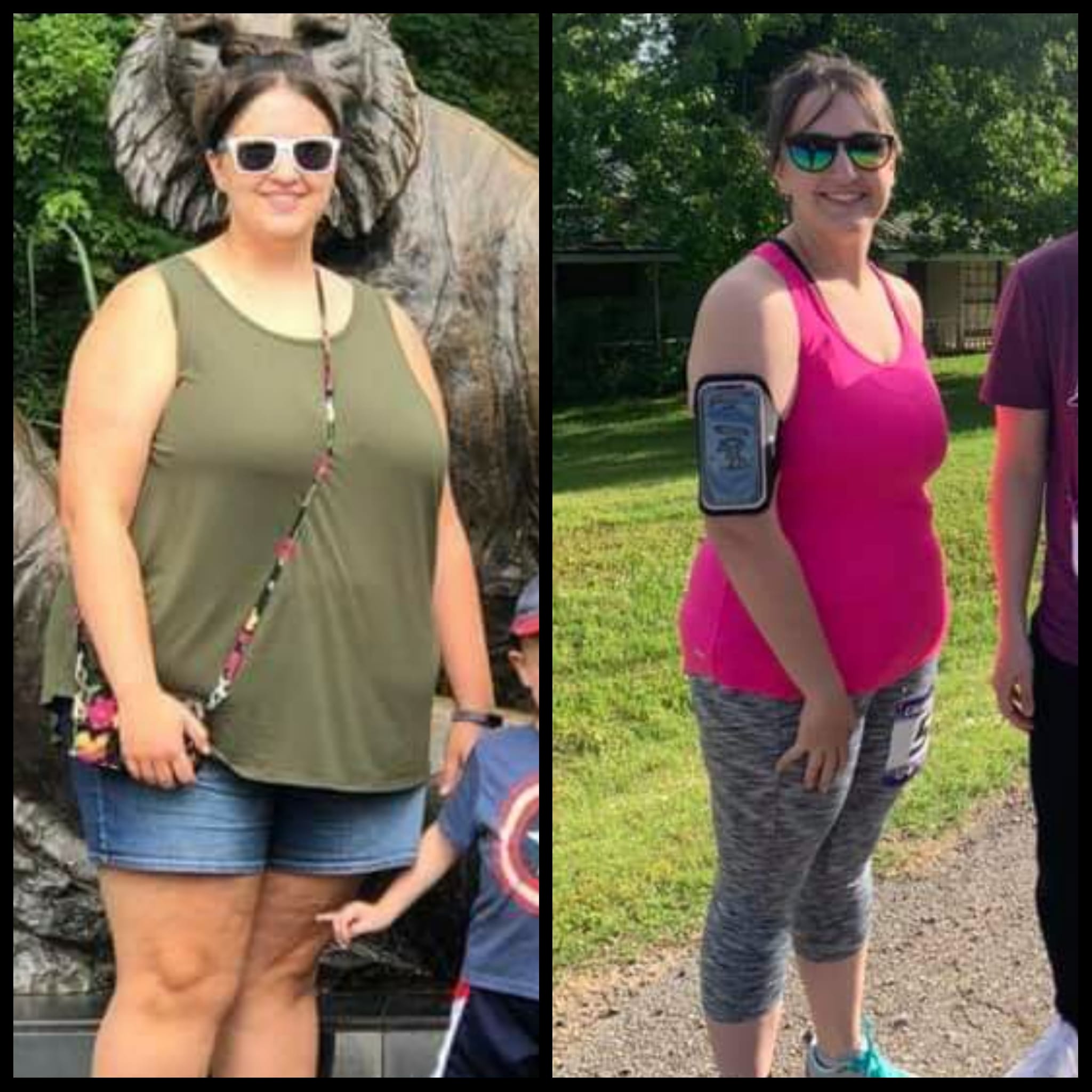 Medical Weight Loss in Tulsa Before & After Photos