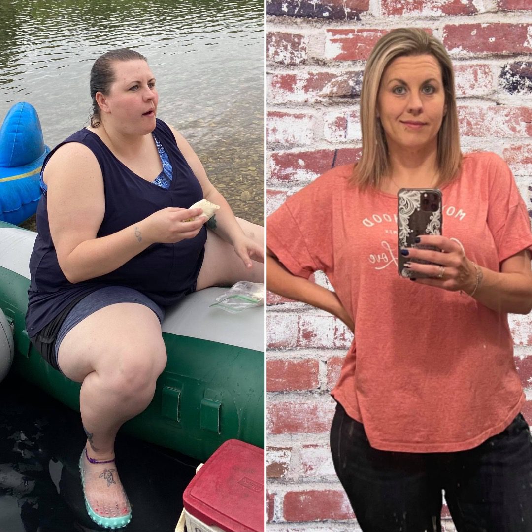 Medical Weight Loss in Tulsa Before & After Photos