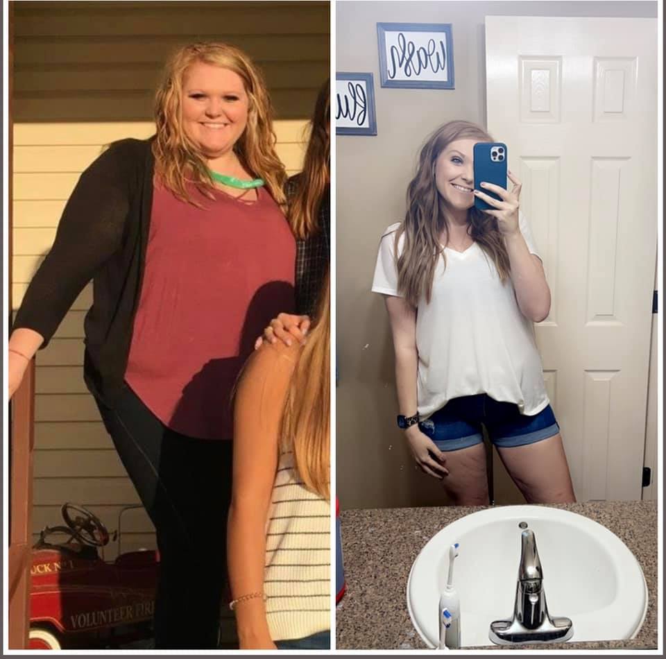Medical Weight Loss in Tulsa Before & After Photos