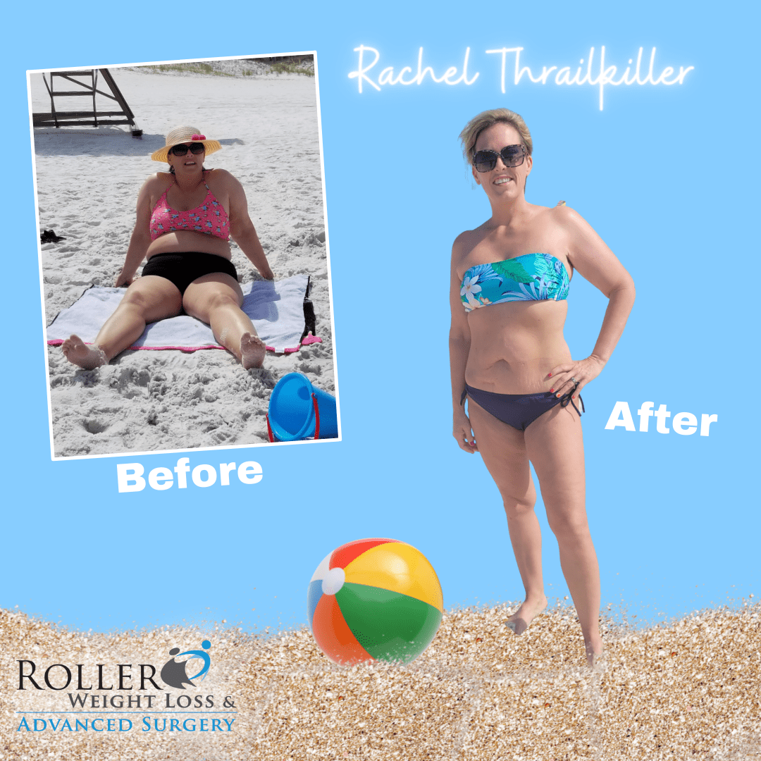 Medical Weight Loss in Tulsa Before & After Photos