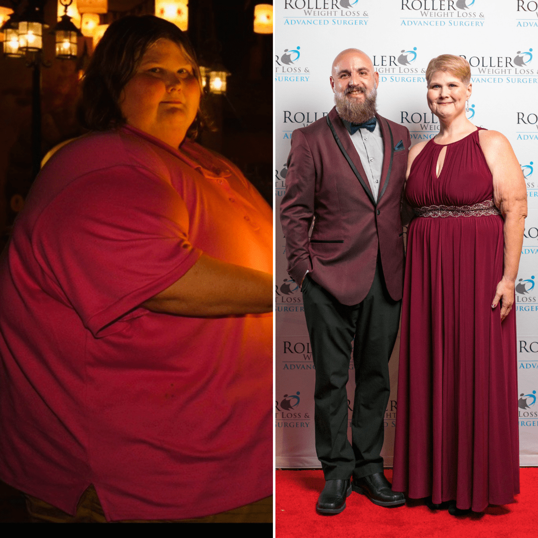 Medical Weight Loss in Tulsa Before & After Photos