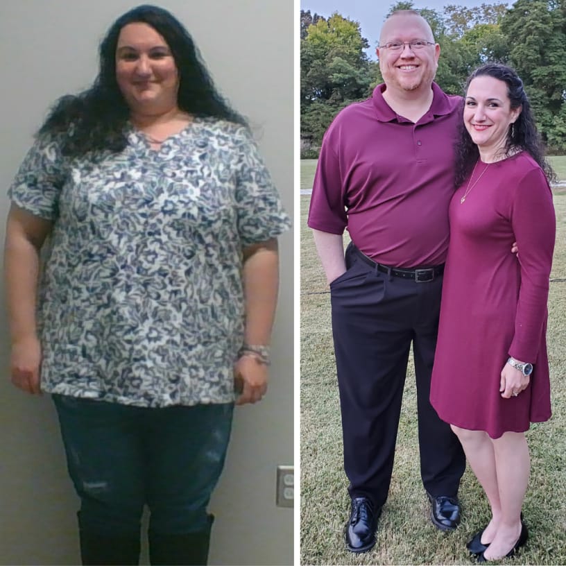 Before and after image of woman from weight loss.