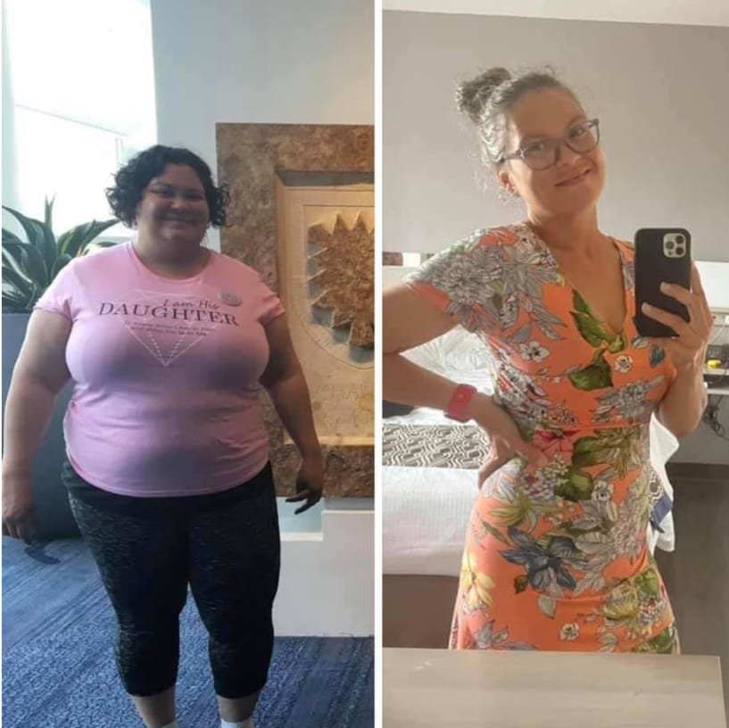 Before and after image of woman from weight loss #2.
