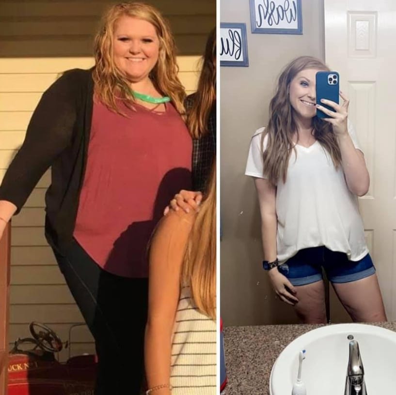 Before and after image of woman from weight loss #3